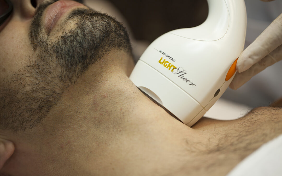 Depilació làser a Palamós amb Làser de Díode LightSheer