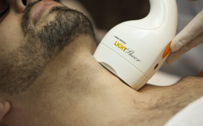 Depilació làser a Palamós amb Làser de Díode LightSheer